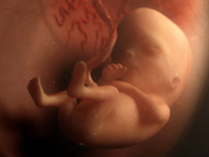 Внутриутробное развитие ребенка, 13 неделя